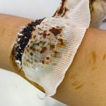 Cleaning ticks on human feet