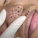 The BEST blackhead nose strip I have ever seen!