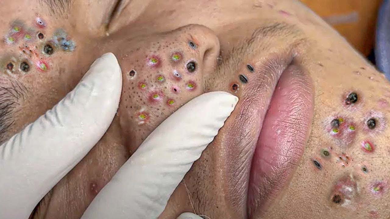 The BEST blackhead nose strip I have ever seen!