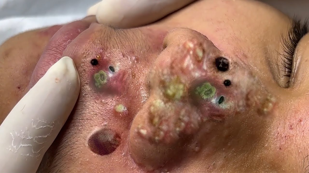 Red Spots on Your Face