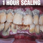 Tips to Protect Your Teeth and Maintain Healthy Smiles