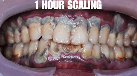 Tips to Protect Your Teeth and Maintain Healthy Smiles
