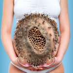 treatment from infected belly
