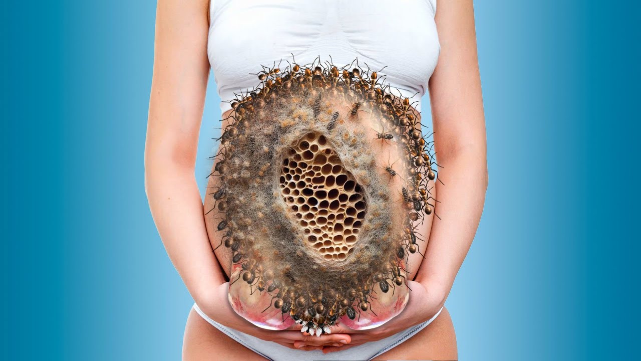 treatment from infected belly