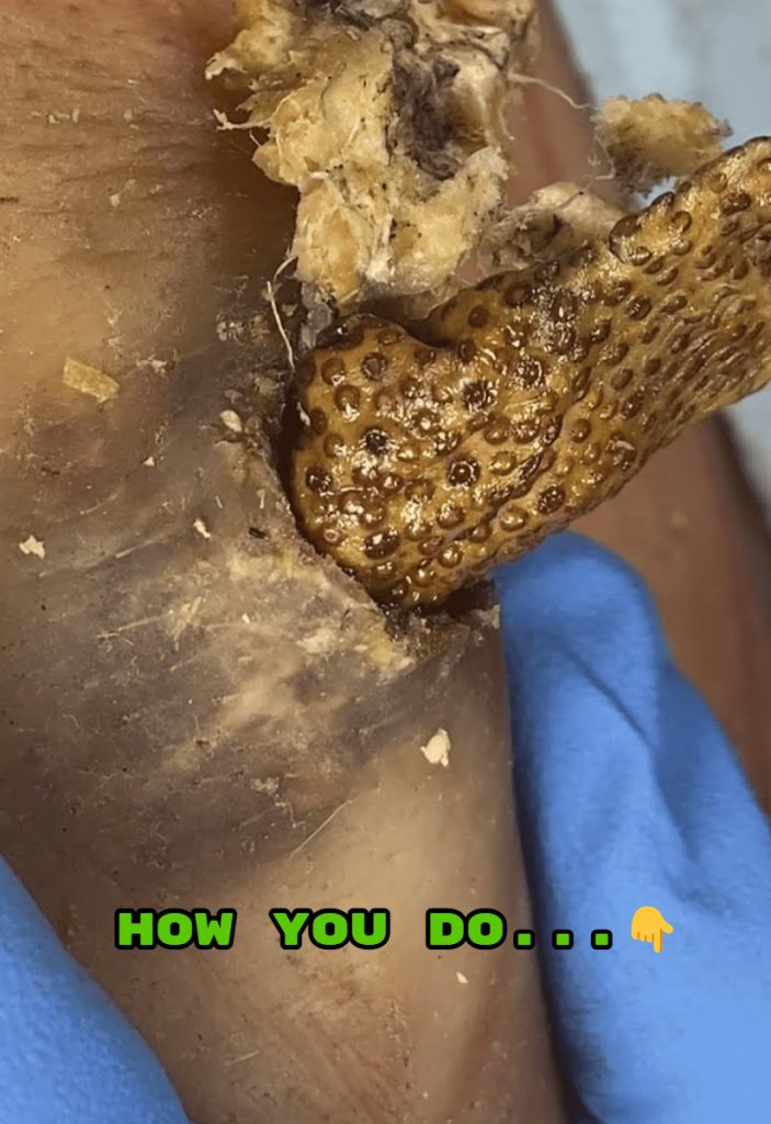 THE BENEFITS OF A GENTLE MORNING CLEANSE