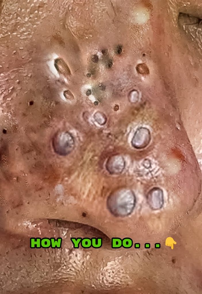 Can I Skip Cleanser in the Morning and Use Toner Instead?