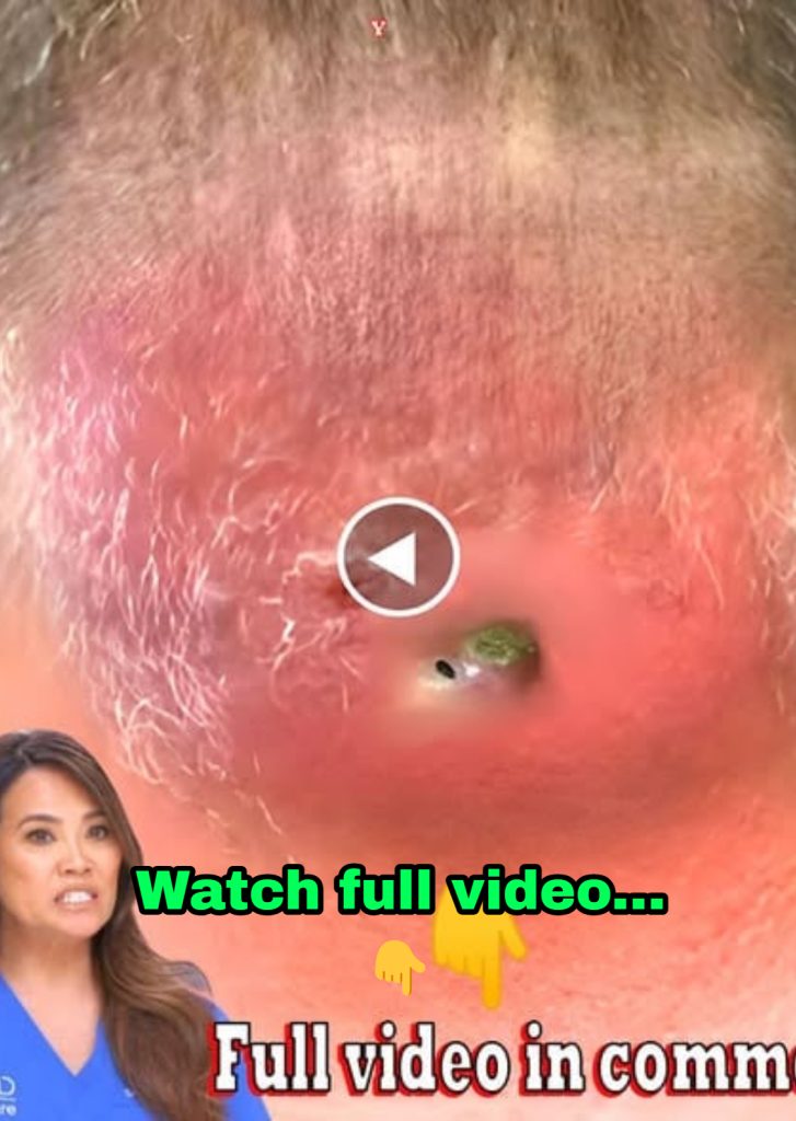 CeraVe Foaming Facial Cleanser