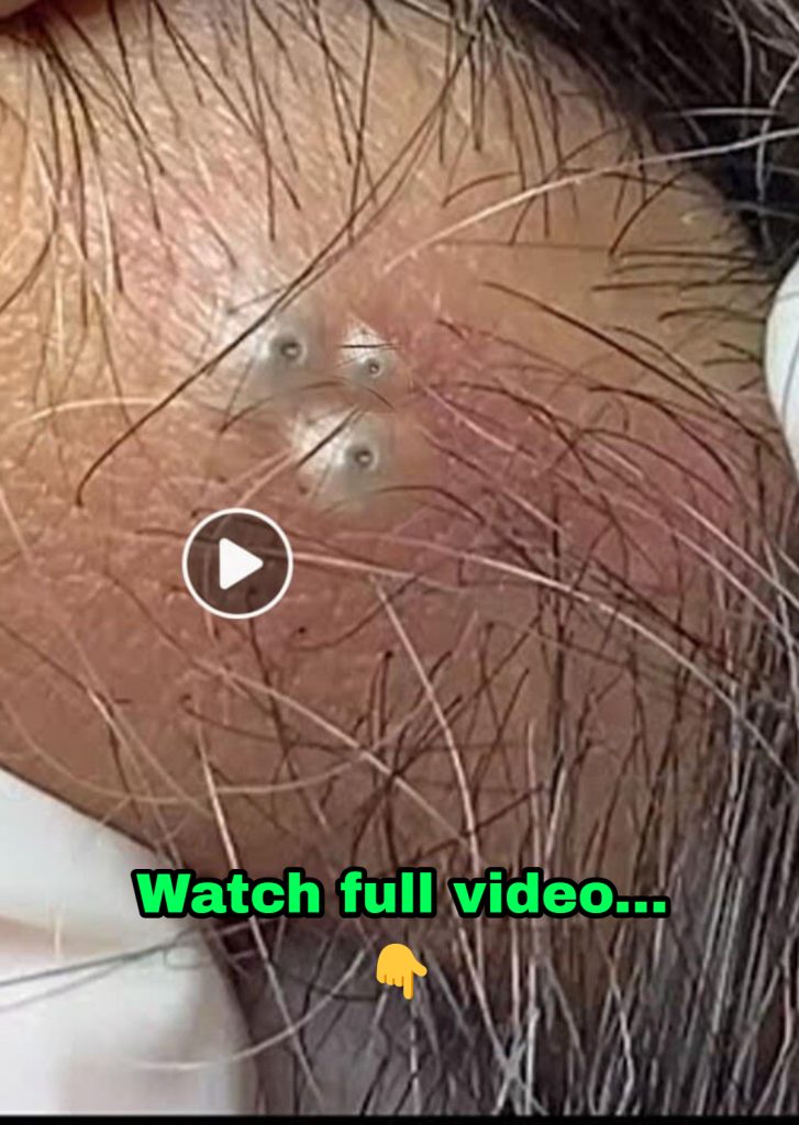 THE BENEFITS OF A GENTLE MORNING CLEANSE