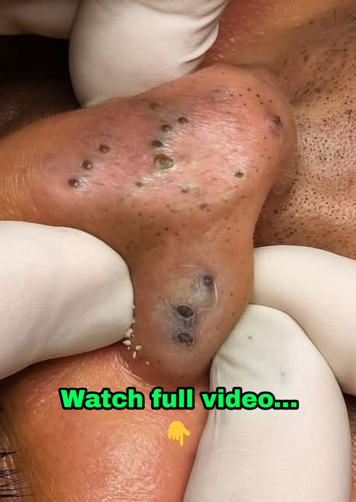 Should You Wash Your Face in the Morning?