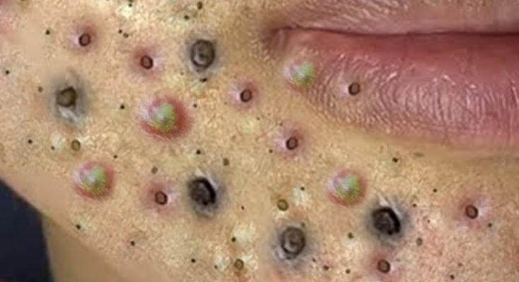 Sleep Style Quiz: What Type of Sleeper Are You?